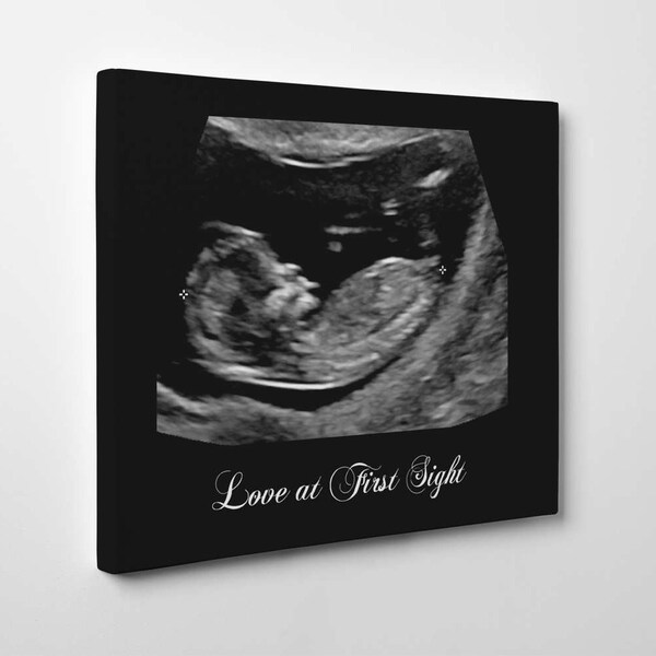 Ultrasound Canvas Etsy