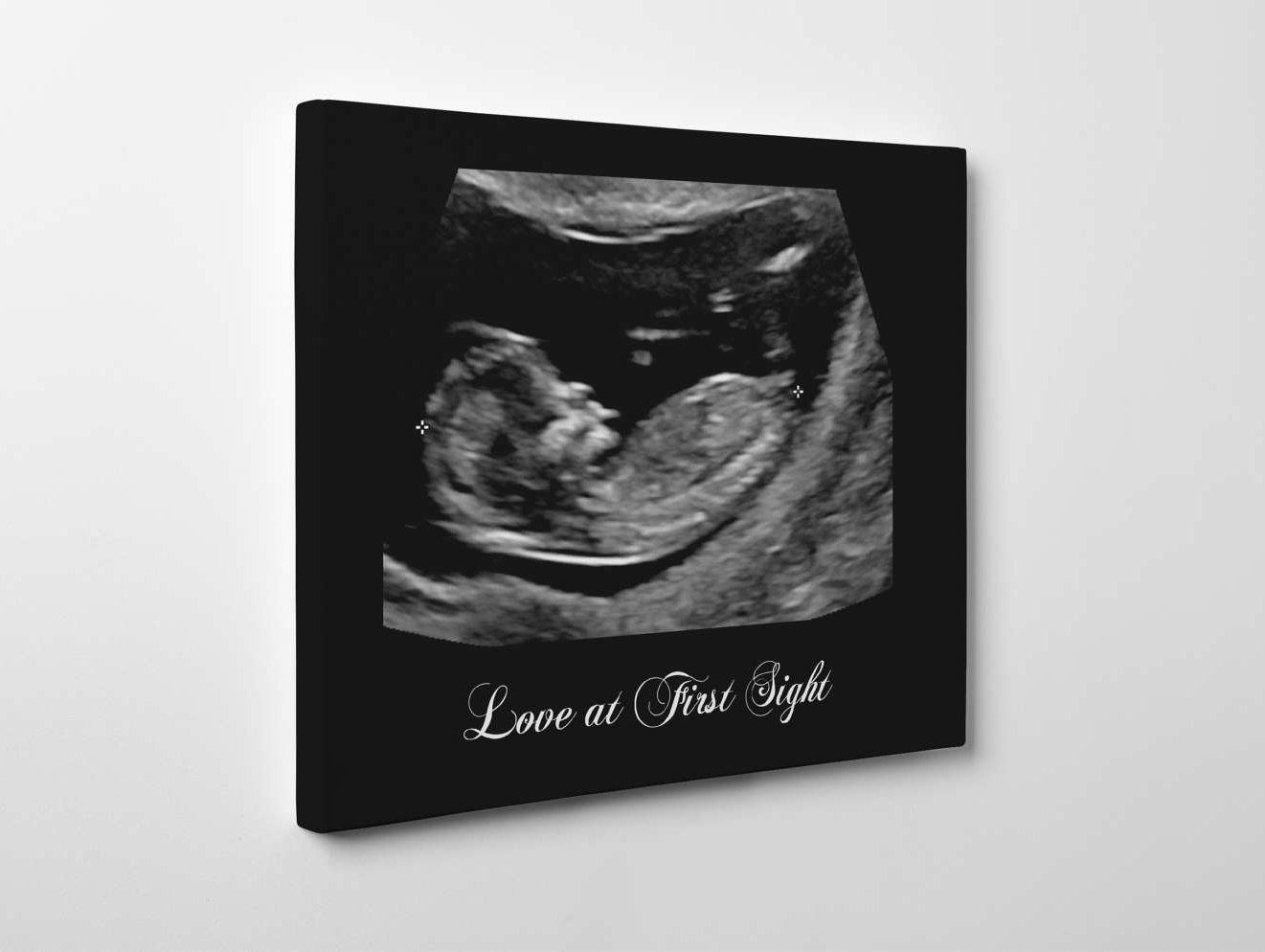 Baby ultrasound picture frame canvas gift