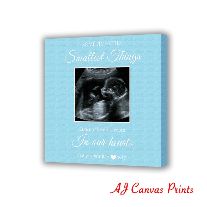Pregnancy Sonogram Ultrasound Canvas Gender Reveal New Baby Etsy