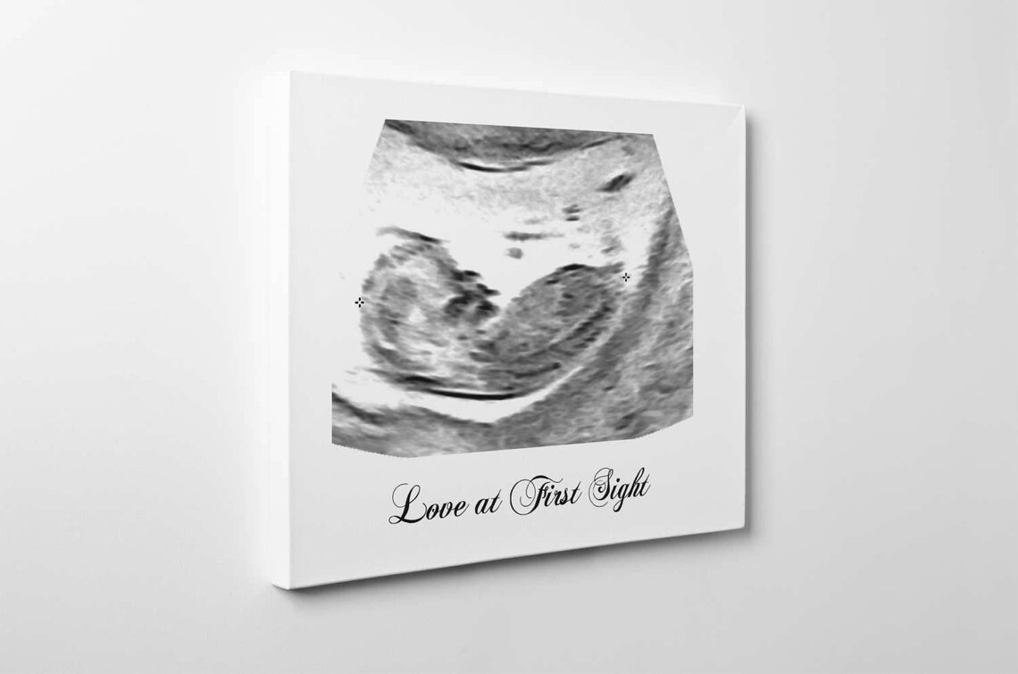 Personalized Baby Ultrasound Canvas Print Etsy