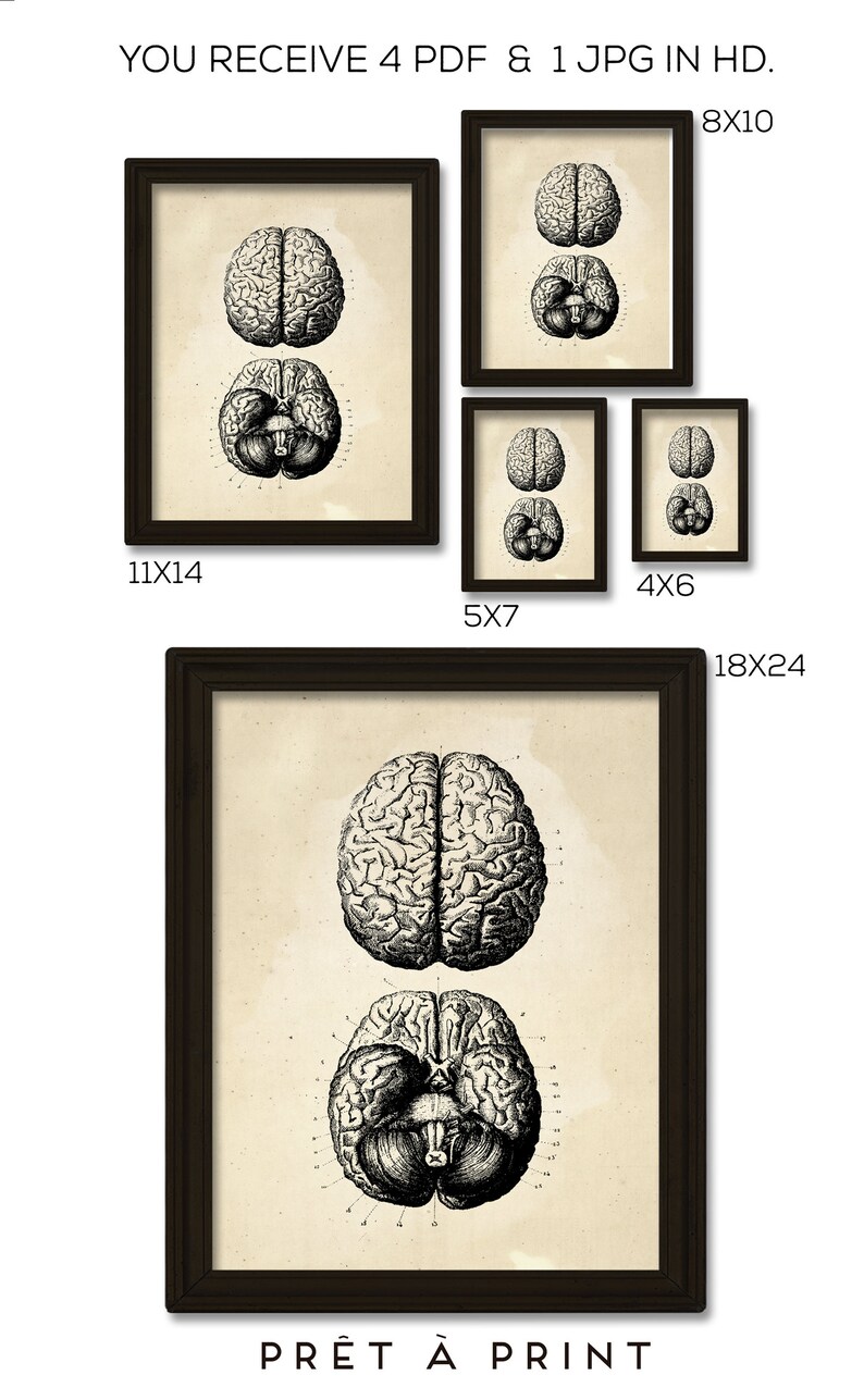 Vintage Human Brain Print: Anatomy Medical Art (digital Print) - Etsy