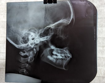 Vintage Skull X-Ray