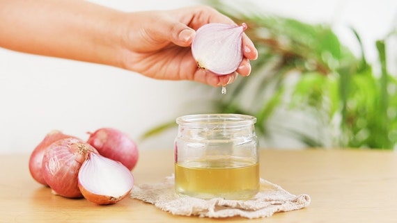 ONION HAIRLOSS TREATMENT oil Best organic oil for beautiful hair. Thick hair growth  oil. Organic. Vegan. Shiny hair. Dandruff treatment.