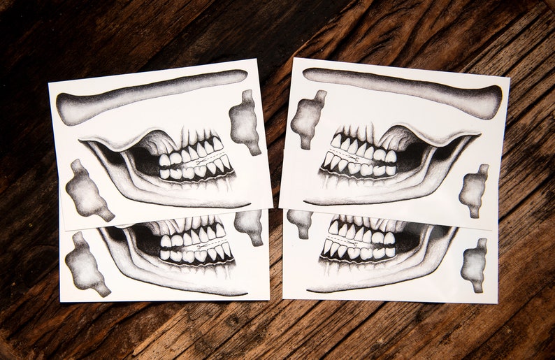 May include: Four sheets of white paper with black and white printed images of a skull's teeth and jawbone. The images are arranged in pairs, with two sheets showing the teeth and jawbone from the left side and two sheets showing the teeth and jawbone from the right side.