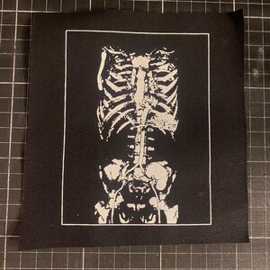 Könnte beinhalten: Schwarz-weiß gestickter Patch mit einer anatomischen Illustration eines menschlichen Skeletts.