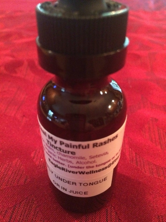Help My Painful Rash Tincture | Etsy