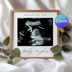 Minimalist Eucalyptus Pregnancy Announcement: Canva Editable Baby Reveal (Digital)