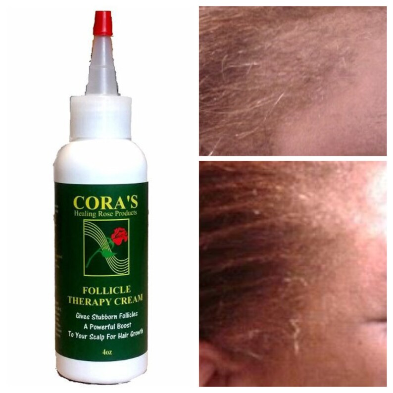 The Follicle Therapy Cream Etsy