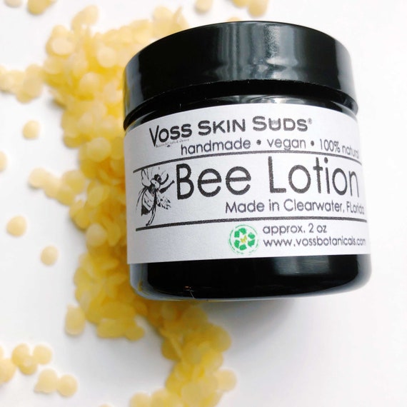 Stretch Marks Stretch Mark Lotion Belly Balm Stretchmarks Etsy