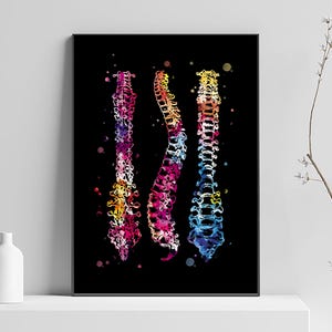 Arte médico, póster de columna vertebral, arte clínico, decoración para médicos, arte quirúrgico, regalo para médicos, arte anatómico