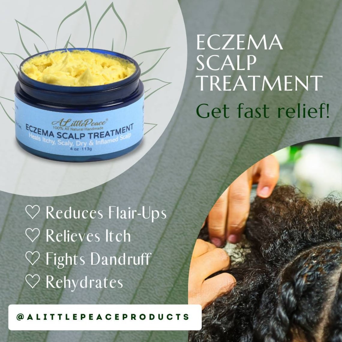 Eczema Scalp Treatment w/Tea Tree & Neem Moisturizer Etsy