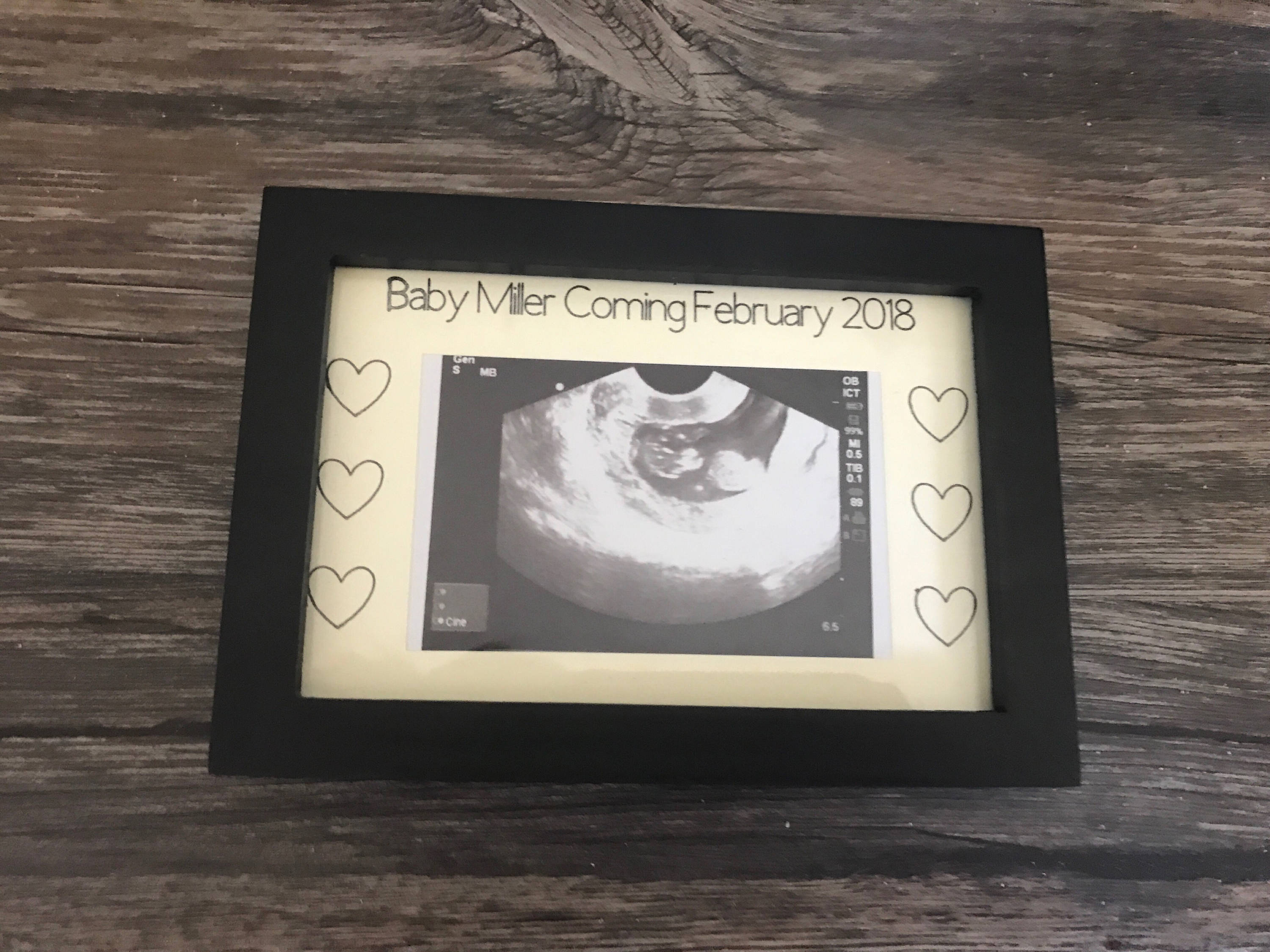 Sonogram Frame Ultrasound Frame Pregnancy Announcement Etsy