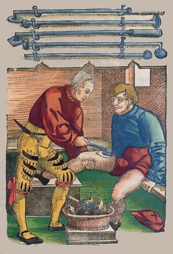 Chirurgien Au Moyen Âge. Entièrement Doublé Medievale