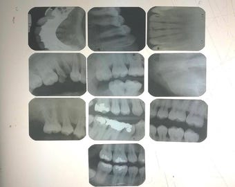 Dental X-rays, Oddities and Curiosities