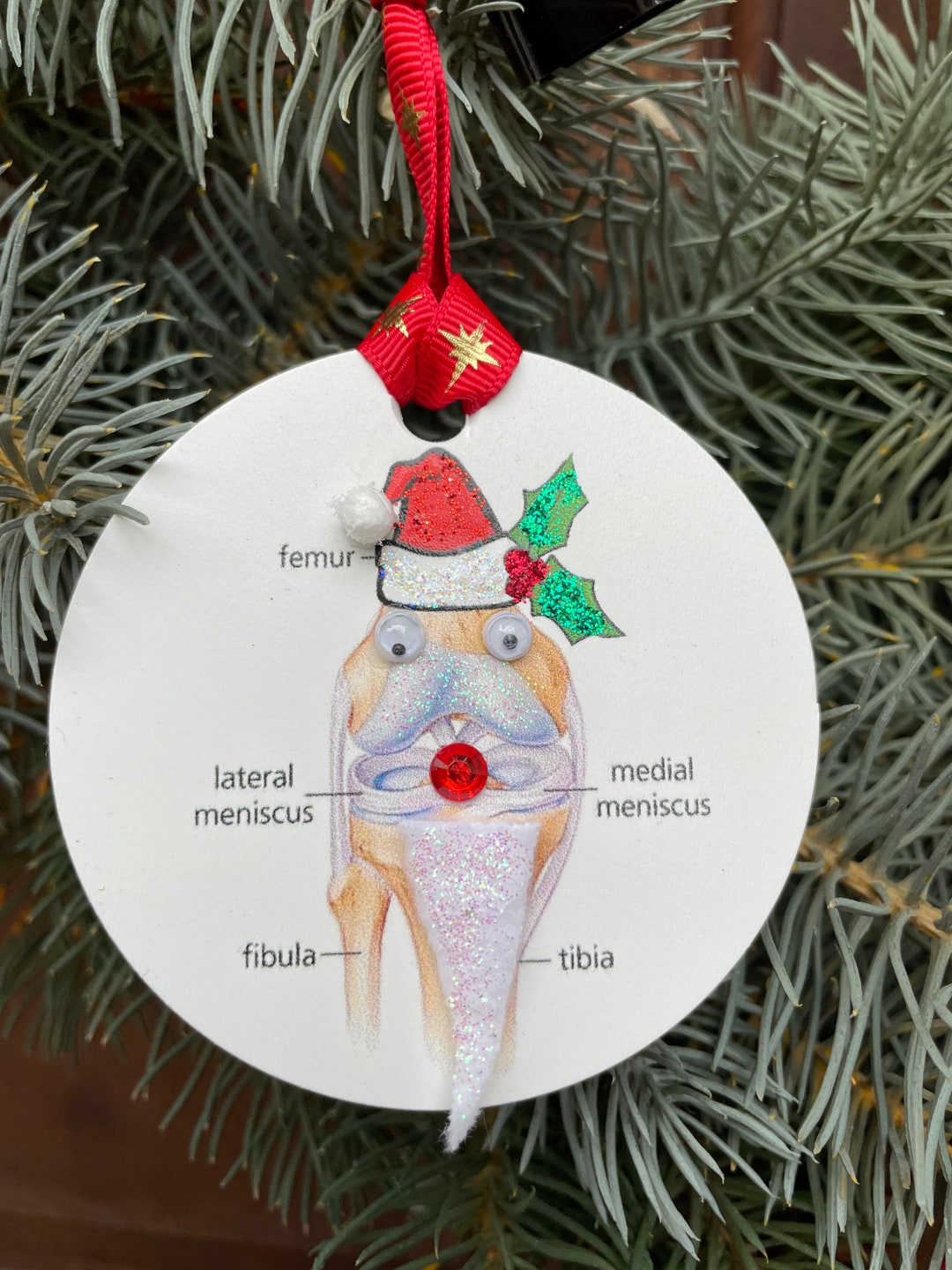 Anatomical Knee Ornament: Orthopedic Surgeon Gift, Medical Christmas ...