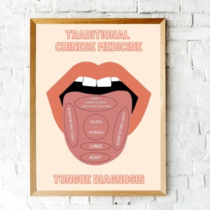 TCM Study Guide, Traditional Chinese Medicine, Tongue Diagnosis Printable Wall Art, Acupuncture Art Poster Gift