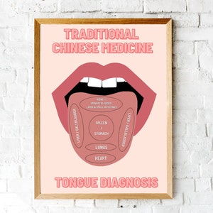 TCM Study Guide, Traditional Chinese Medicine, Tongue Diagnosis Printable Wall Art, Acupuncture Art Poster Gift