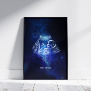 Ultrasound art Stillborn memorial Baby scan Stillbirth memorial Baby loss Digital printable footprint Miscarriage print Pregnancy keepsake