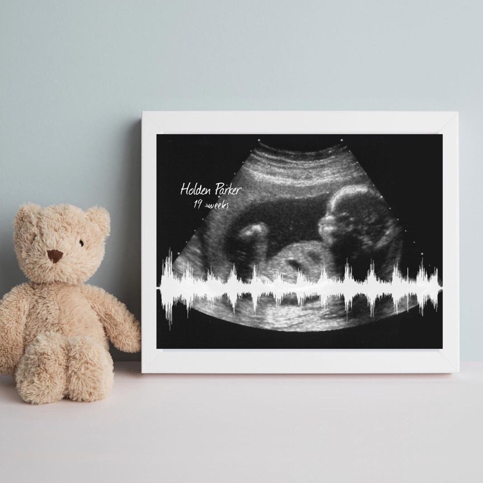 Ultrasound Sonogram Personalized Baby Heartbeat Art Canvas Etsy