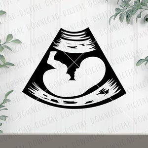 Puede incluir: Silueta en blanco y negro de una imagen de ultrasonido que muestra un bebé en el útero.