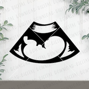 Puede incluir: Silueta en blanco y negro de una imagen de ultrasonido que muestra un bebé en el útero.