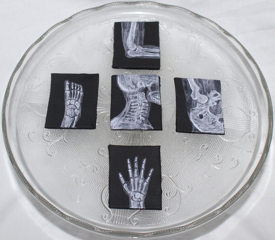 Fondant Xray Cake Topper Fondant Radiology Fondant Medical Radiology