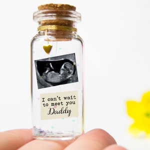 Ultrasound Gift - Can't wait to meet you Daddy- Custom Baby Ultrasound Sonogram - gift for New Dad Gift for daddy to be Gift for Grandma Mom