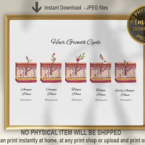Hair Growth Cycle Art, Hair Growth Poster, Hair Anatomy Art, Dermatology Art, Aesthetic Nurse Art, Esthetician Decor, Printable Art