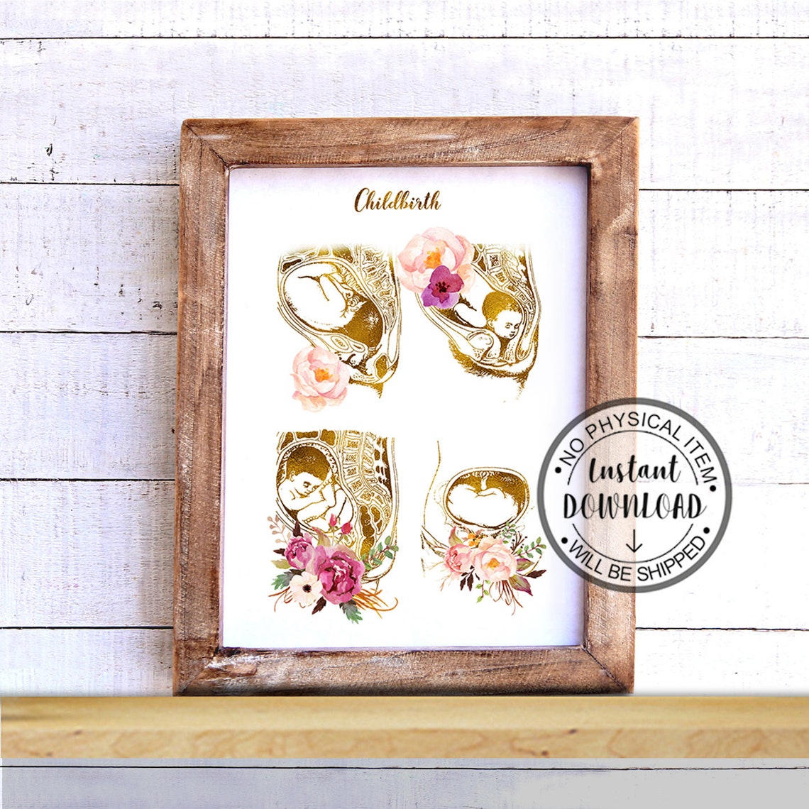 Midwife Print Printable Art Obgyn Art Print Midwife Office - Etsy UK