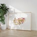 Pancreas Anatomy Art, Medical Office Decor, Hepatology ...