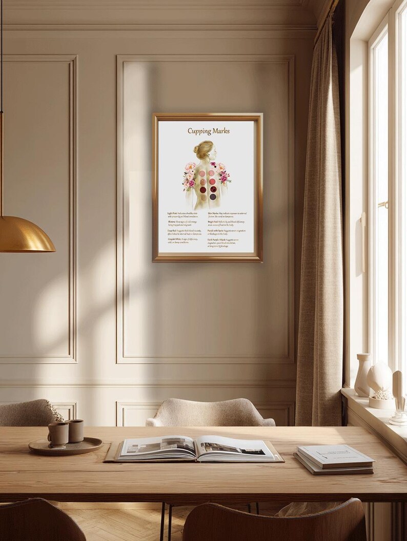 Cupping Therapy Art Print for Holistic Healing Rooms | Traditional Cupping Poster for Massage & Wellness Spaces | Printable Wall Art image 6