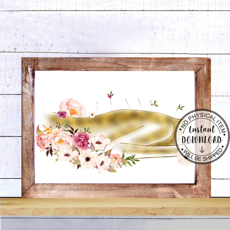 Acupuncture Art Print Acupuncture Poster Acupuncture Clinic Etsy