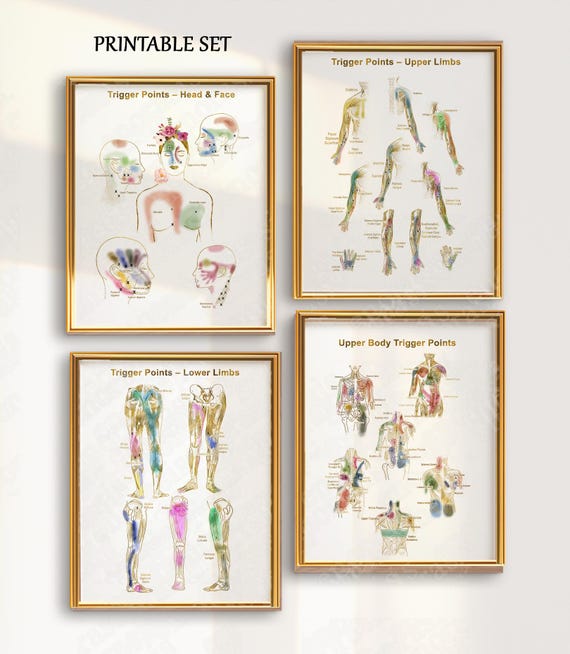 2-Pack Laminated Trigger Points Posters - 17.3x22.5 Inch Anatomy Charts For Medical Education & Therapy