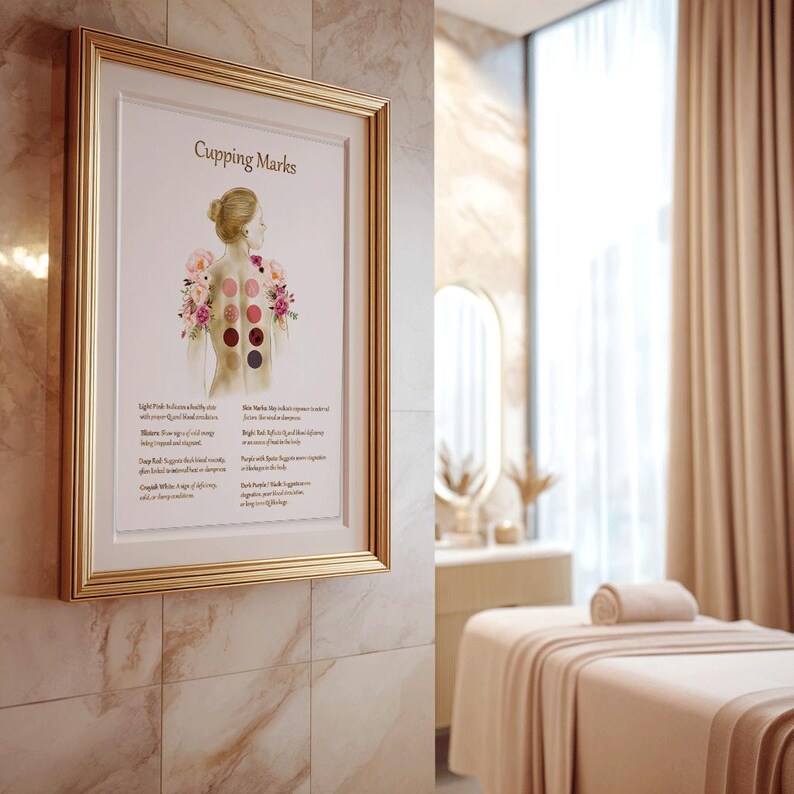 Cupping Therapy Art Print for Holistic Healing Rooms | Traditional Cupping Poster for Massage & Wellness Spaces | Printable Wall Art image 7