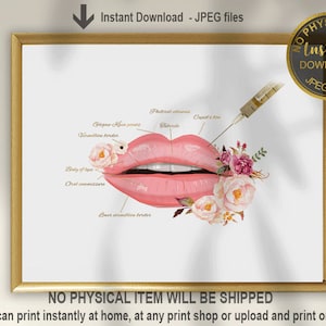 Lip Anatomy Art, Lip Filler Print, Plastic Surgeon Gift, Botox Art, Cosmetic Surgery Print, Esthetic Surgery, Esthetician Decor, Printable