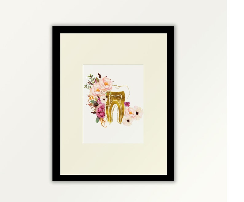 Dents Dentisterie Dent Implant Dentiste Clinique Mur Art Toile Peinture Or Cadre Imprime Photo Pour Bureau Dentaire Décor 90x120cm/35x47in Cadre Doré