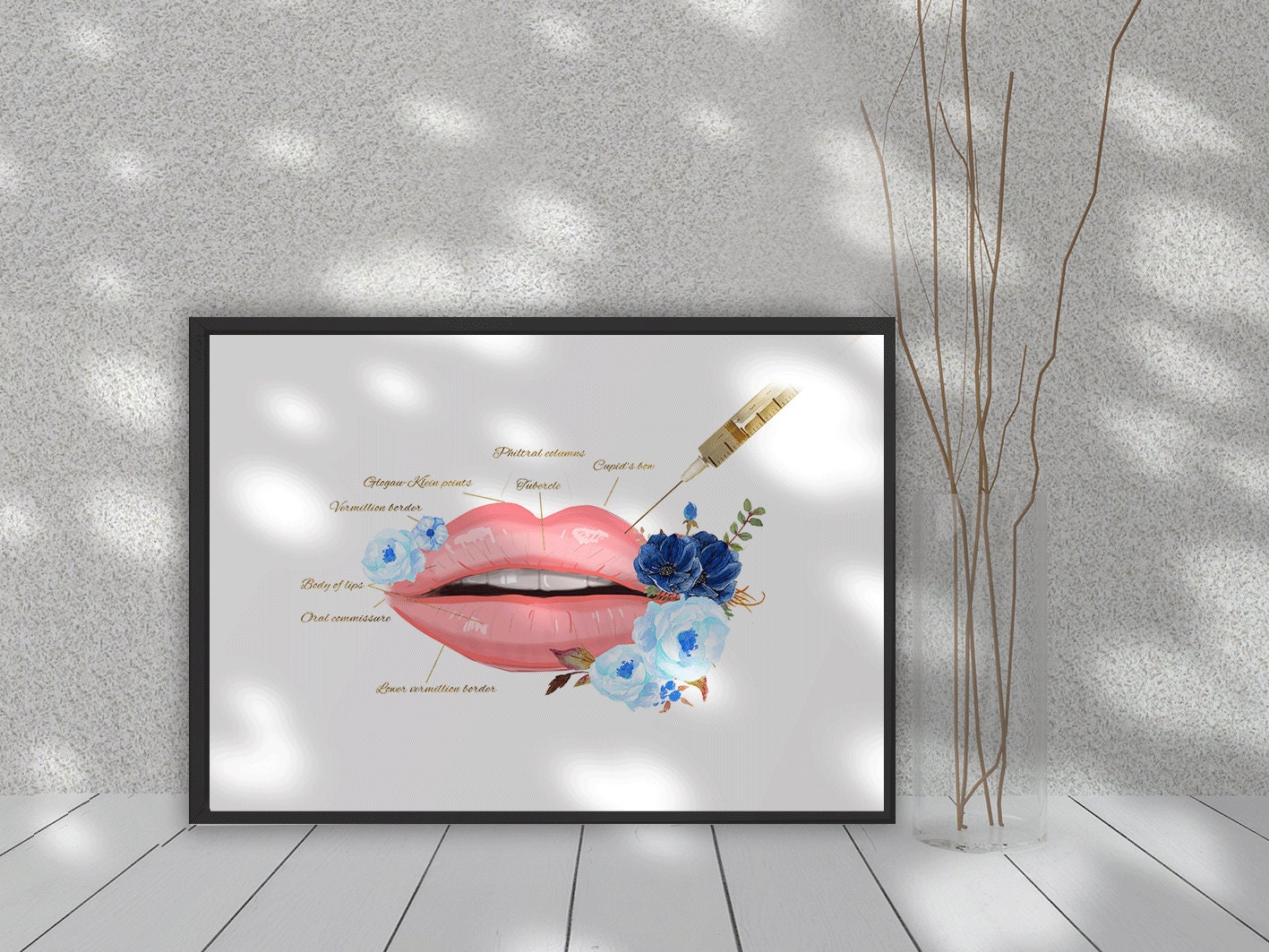 Lip Injection Print Lip Anatomy Art Printable Wall Art Etsy