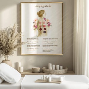Cupping Therapy Art Print for Holistic Healing Rooms | Traditional Cupping Poster for Massage & Wellness Spaces | Printable Wall Art image 8