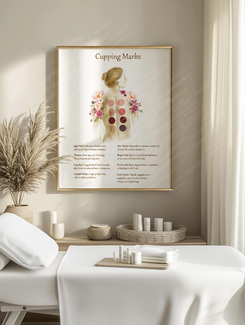 Cupping Therapy Art Print for Holistic Healing Rooms | Traditional Cupping Poster for Massage & Wellness Spaces | Printable Wall Art image 8