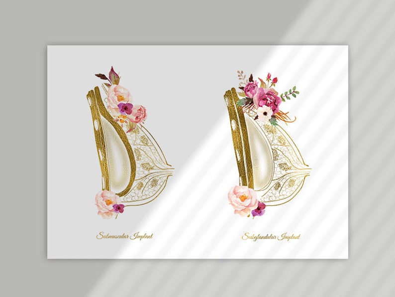 May include: Two anatomical illustrations of breast implants, one submuscular and one subglandular, with watercolor floral accents in shades of pink and purple. The text "Submuscular Implant" and "Subglandular Implant" is below each illustration.