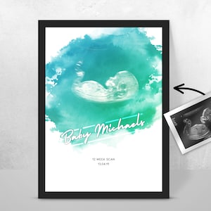 Personalised BABY Scan Ultrasound Watercolour Print 4D first baby scan/Baby Shower Gift/ New mum to be/ Bump gift/ Pregnancy Keepsake Mum