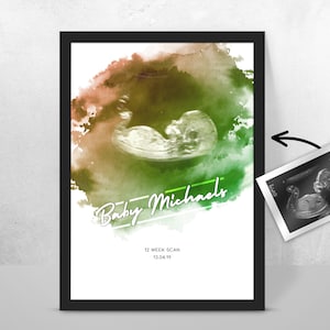 Personalised BABY Scan Ultrasound Watercolour Print 4D first baby scan/Baby Shower Gift/ New mum to be/ Bump gift/ Pregnancy Keepsake Mum