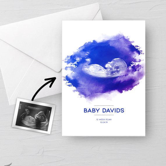 Personalised BABY Scan Ultrasound Watercolour greeting card 4D first baby  scan/Baby Shower Gift/ New mum to be/ Bump gift/Congratulations