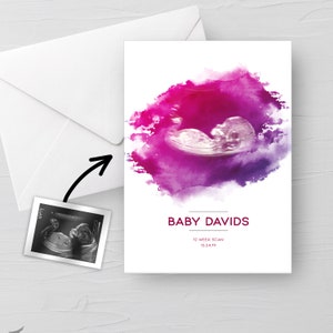 Personalised BABY Scan Ultrasound Watercolour greeting card 4D first baby scan/Baby Shower Gift/ New mum to be/ Bump gift/Congratulations