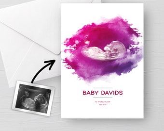 Puede incluir: Un fondo de acuarela rosa y morado con una imagen de ultrasonido en blanco y negro de un bebé en el centro. El texto "BABY DAVIDS" está debajo de la imagen, junto con "12 WEEK SCAN 13.04.19".