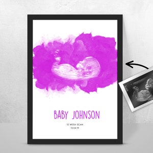Personalised BABY Scan Ultrasound Watercolour Print 4D first baby scan/Baby Shower Gift/ New mum to be/ Bump gift/ Pregnancy Keepsake Mum