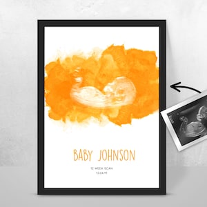 Personalised BABY Scan Ultrasound Watercolour Print 4D first baby scan/Baby Shower Gift/ New mum to be/ Bump gift/ Pregnancy Keepsake Mum