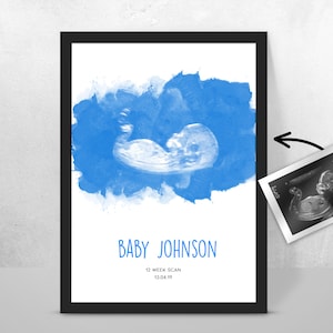 Personalised BABY Scan Ultrasound Watercolour Print 4D first baby scan/Baby Shower Gift/ New mum to be/ Bump gift/ Pregnancy Keepsake Mum