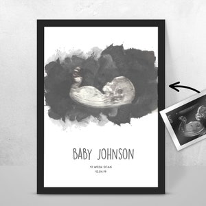 Personalised BABY Scan Ultrasound Watercolour Print 4D first baby scan/Baby Shower Gift/ New mum to be/ Bump gift/ Pregnancy Keepsake Mum