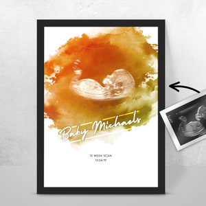 Personalised BABY Scan Ultrasound Watercolour Print 4D first baby scan/Baby Shower Gift/ New mum to be/ Bump gift/ Pregnancy Keepsake Mum